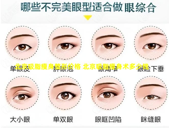 北京吸脂瘦身整形价格 北京吸脂瘦身术多少钱
